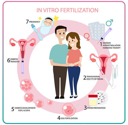IVF Treatment Process