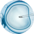 Mini IVF